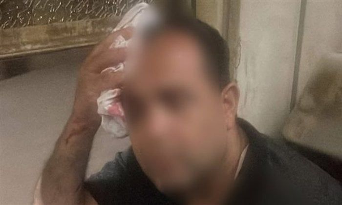 أمن المنوفية يحقق في إصابة راكب بقطار إثر رشقه بالحجارة أمن المنوفية يحقق في إصابة راكب بقطار إثر رشقه بالحجارة