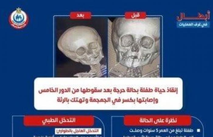 بالبلدي : إنقاذ
      حياة
      طفلة
      بعد
      سقوطها
      من
      الدور
      الخامس
      وتهتك
      بالرئة