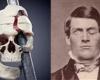 بالبلدي : بعد وفاته بـ 162 عاما.. الطب الشرعي يعيد بناء جمجمة رجل أمريكي اخترقت وجهه قطعة حديدية