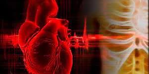 بالبلدي : تقنية غير جراحية تساعد على تصوير الخلايا الالتهابية في القلب