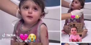 بالبلدي: بعد إصابتها البالغة.. طفلة تثير الجدل على السوشيال ميديا| شاهد belbalady.net