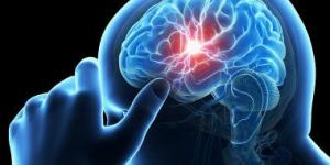 بالبلدي: اليوم العالمى للسكتة الدماغية.. 7 عوامل تزيد من خطر الإصابة