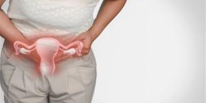 بالبلدي : تشنجات الدورة الشهرية والتهاب بطانة الرحم.. أعراض تكشف الفرق بينهما