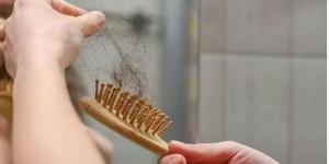 بالبلدي: علامات خطيرة لـ تساقط الشعر| خلي بالك belbalady.net