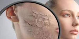 بالبلدي : 5 أسباب تجعلكِ تتجنبين استخدام الصابون لغسل الوجه.. جفاف البشرة أبرزها
