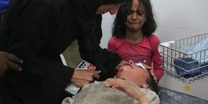 بالبلدي: يونيسف: الرضع في غزة يعانون سوء التغذية الحاد belbalady.net