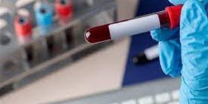 بالبلدي : تطوير تحليل دم يتنبأ بالإنتان وفشل الأعضاء عند الأطفال