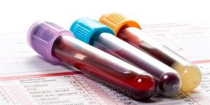 بالبلدي : اختبار الدم يكشف الإصابة بسرطان البنكرياس المبكر بدقة تصل إلى 97%.. تفاصيل