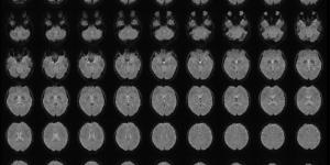 بالبلدي: عالِم يحوّل الصور الذهنية في أدمغة البشر إلى نصوص.. كيف ذلك؟