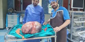 رئيس
      جامعة
      المنيا
      يُهنئ
      الفريق
      الطبي
      بنجاح
      استئصال
      ورم
      مبيضي
      عملاق
      يزن
      24
      كيلوجرامًا