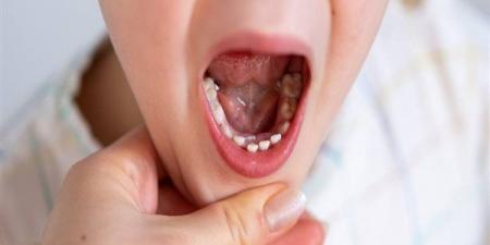 بالبلدي : ما يجب فعله مع الطفل عند زيارته لطبيب الأسنان