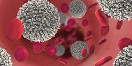 بالبلدي : استراتيجية علاجية جديدة محتملة لسرطان الدم العدواني