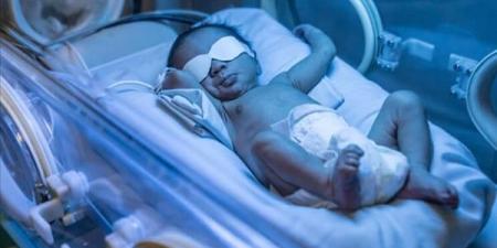بالبلدي : علاج اليرقان عند حديثي الولادة.. ما دور الضوء الأزرق؟