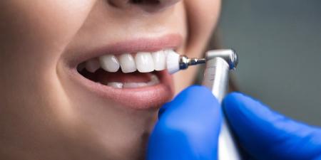 بالبلدي : أخصائي يكشف مضاعفات تسوس الأسنان.. محاذير خطيرة