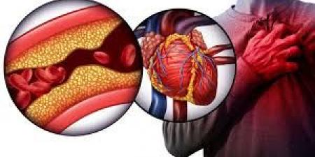 بالبلدي : دراسة: الأصدقاء والعائلة يقللون من الإصابة بأمراض القلب بنسبة تصل إلى 30%