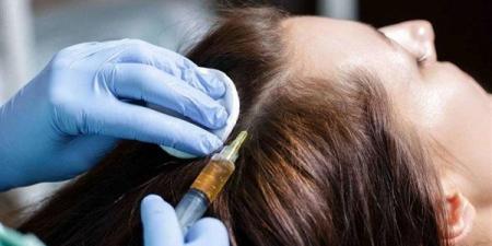 بالبلدي : تعرف على فوائد حقن البلازما في علاج مشاكل الشعر