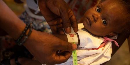 بالبلدي : اليونيسيف: الأطفال يواجهون مخاطر صحية كبيرة بسبب الكوليرا في نيجيريا