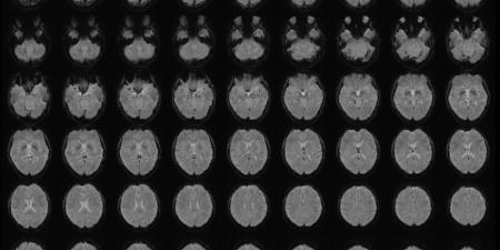 بالبلدي: عالِم يحوّل الصور الذهنية في أدمغة البشر إلى نصوص.. كيف ذلك؟