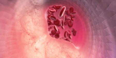 بالبلدي: دراسة: حبّة تجريبية واعدة تخفّض الكوليسترول الضار بنسبة 60%