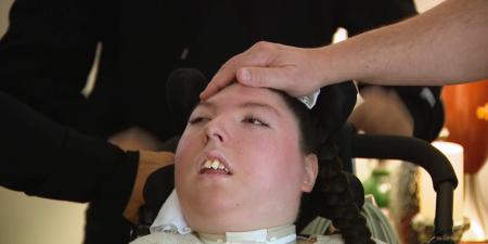 بالبلدي: وُلدت بِلا دماغ وتوقع الأطباء ألا تعيش أكثر من أربع سنوات.. أليكس تحتفل بعامها العشرين