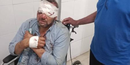 بالبلدي: إصابة
      معلمين
      في
      انقلاب
      دراجة
      نارية
      أثناء
      توجههما
      للمراقبة
      ببني
      سويف..
      ونقابة
      المعلمين
      تتحرك
      فورًا