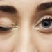 بالبلدي : رفة العين| طبيب يوضح أسبابها.. وكيفية علاجها؟