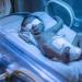 بالبلدي : علاج اليرقان عند حديثي الولادة.. ما دور الضوء الأزرق؟