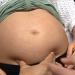 belbalady ما هي الأسباب الرئيسية لوفاة الأمهات بعد الولادة؟