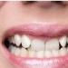 بالبلدي : أمراض منتشرة سببها مشكلة في الأسنان.. أخصائي يكشفها