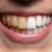 بالبلدي : طبيب أسنان يحذر من الإفراط في تناول هذه الفواكه.. ما السبب؟