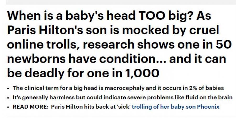 بالبلدي: باريس هيلتون ترد على منتقدى حجم رأس طفلها.. 1من كل 50 طفلا يصاب بها