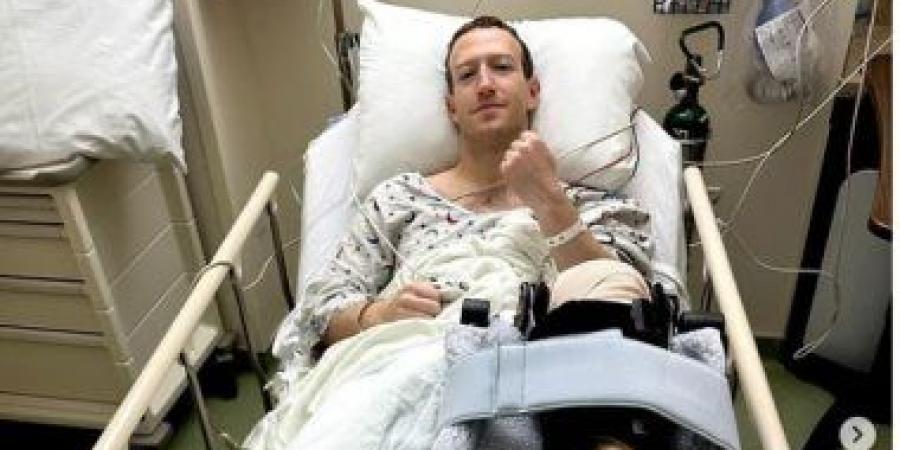 بالبلدي: مارك زوكربيرج يخضع لعملية جراحية بسبب إصابة فى الركبة
