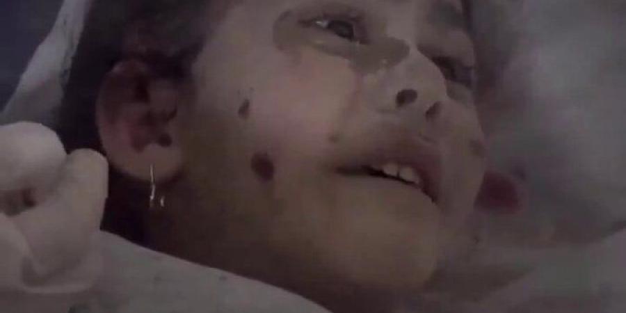 بالبلدي: هذا حلم ولا جد يا عمو.. "مرح" طفلة فلسطينية لا تصدق ما حدث من قصف