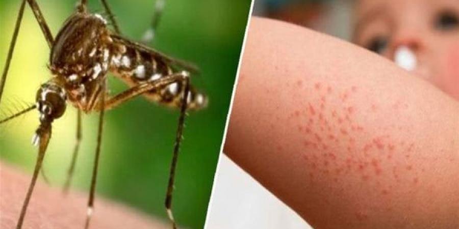 بالبلدي: الصحة تكشف تفاصيل حمى غرب النيل وطرق انتقال المرض ومراحل الخطورة belbalady.net