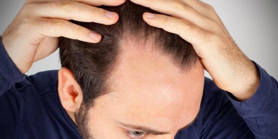 بالبلدي : أخصائية تغذية: تساقط الشعر وصعوبة التئام الجروح علامة على نقص هذا العنصر بالجسم