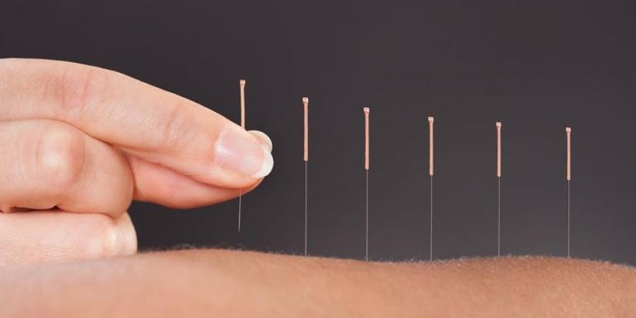 بالبلدي : هل يمكن علاج النحافة بالإبر الصينية؟