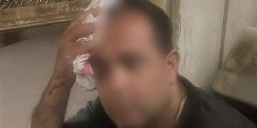 بالبلدي: أمن
      المنوفية
      يحقق
      في
      إصابة
      راكب
      بقطار
      إثر
      رشقه
      بالحجارة