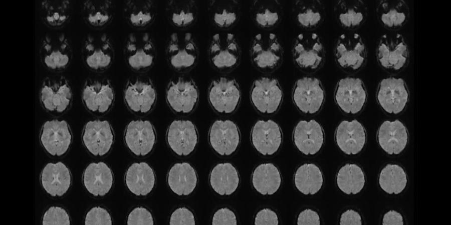 belbalady تقنية يابانية جديدة تحوّل الصور الذهنية إلى أوصاف دقيقة بواسطة الذكاء الاصطناعي