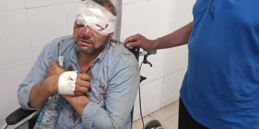 بالبلدي: إصابة
      معلمين
      في
      انقلاب
      دراجة
      نارية
      أثناء
      توجههما
      للمراقبة
      ببني
      سويف..
      ونقابة
      المعلمين
      تتحرك
      فورًا