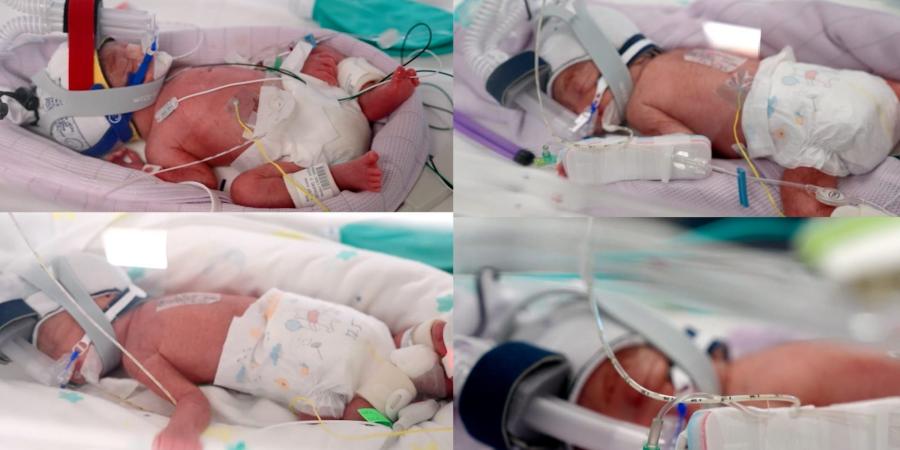 بالبلدي: مفاجأة نادرة في أستراليا.. أم تنجب أربع توائم متطابقات من بويضة واحدة