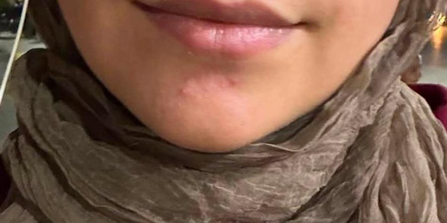 بالبلدي : «لو
      اختفيت
      يبقى
      بسبب
      أهلي»..
      التفاصيل
      الكاملة
      لاستغاثة
      فتاة
      بني
      سويف